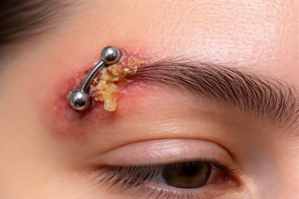 Risks and Potential Complications