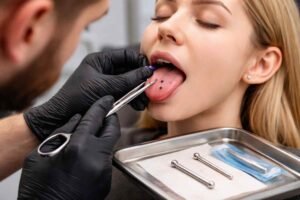 Placement and Procedure